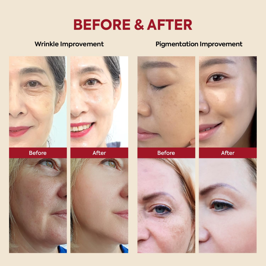 K-SECRET Seoul 1988 Retinal Cream – For Dark Circles, Fine Lines & Brightening – Smooths Texture, Firms Skin, Hydrates & Balances Tone – Anti-Aging Intensive Eye Zone Care