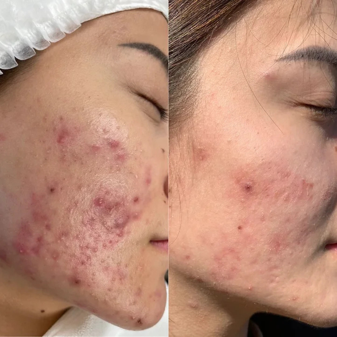 Arencia Vitamin C Cream | Removes Dark Spots & Pigmentation | Reduces Fine Lines & Wrinkles | Anti-Aging & Acne Mark Fading | Deep Hydration & Skin Brightening