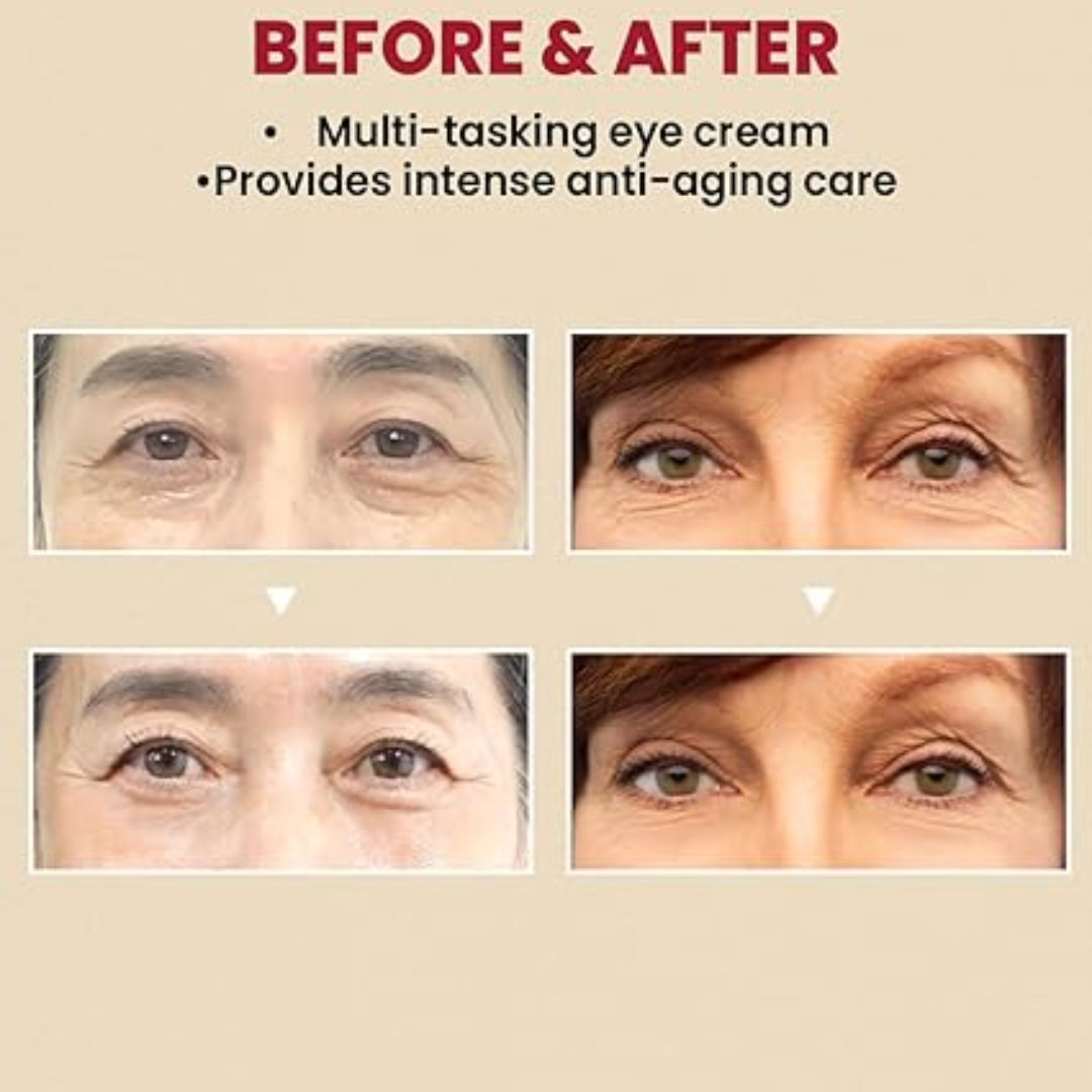 K-SECRET Seoul 1988 Retinal Cream – For Dark Circles, Fine Lines & Brightening – Smooths Texture, Firms Skin, Hydrates & Balances Tone – Anti-Aging Intensive Eye Zone Care