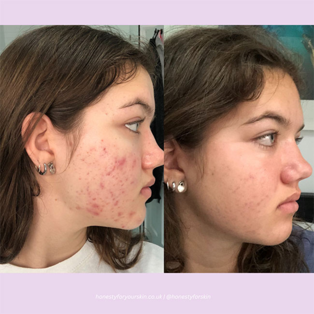 Arencia Vitamin C Cream | Removes Dark Spots & Pigmentation | Reduces Fine Lines & Wrinkles | Anti-Aging & Acne Mark Fading | Deep Hydration & Skin Brightening