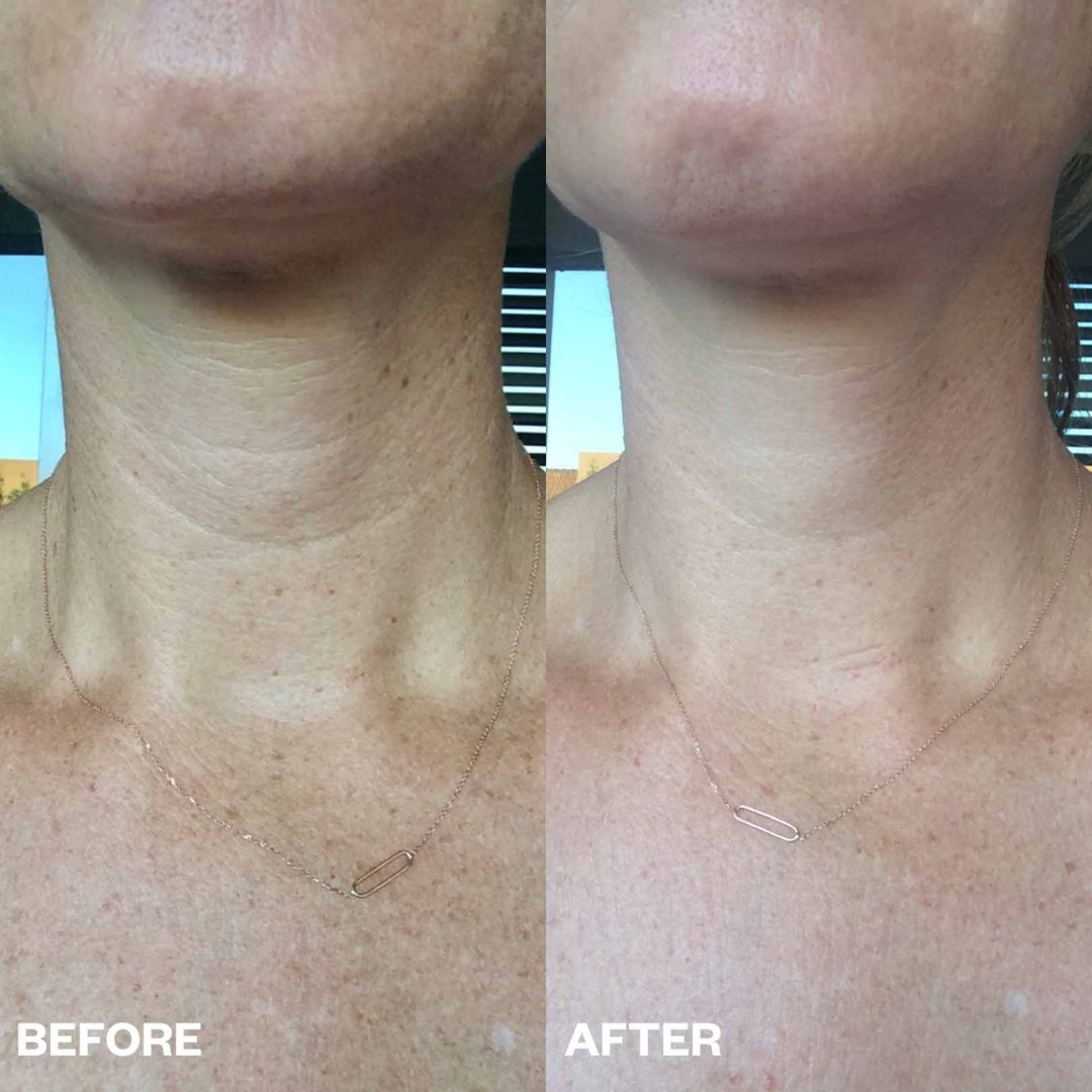 Sisley Paris Neck Cream – Firmer, Smoother & Younger-Looking – Enriched Formula for a Firmer Neck & Refined Contour – Firms & Tightens, Refines Neck Lines, Deeply Nourishes