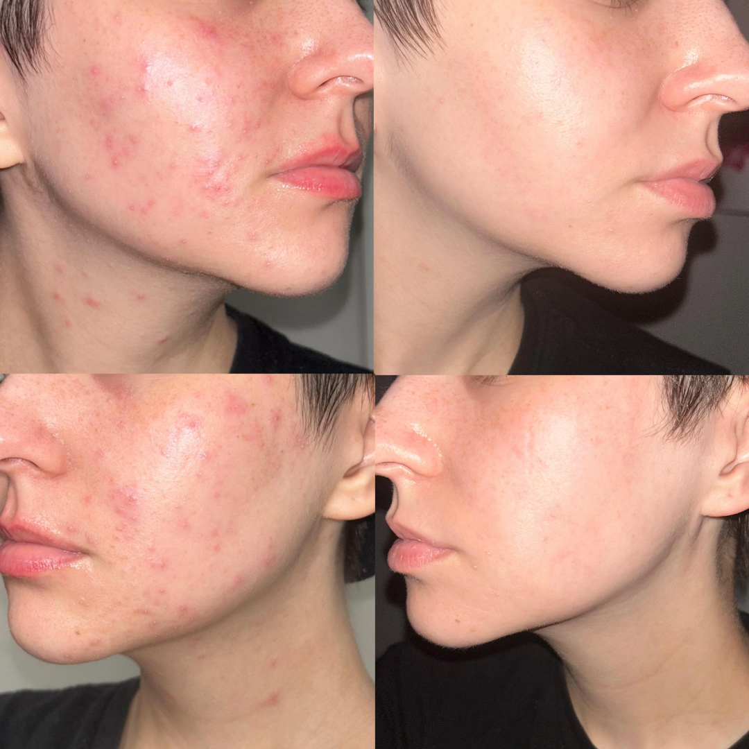 Arencia Vitamin C Cream | Removes Dark Spots & Pigmentation | Reduces Fine Lines & Wrinkles | Anti-Aging & Acne Mark Fading | Deep Hydration & Skin Brightening