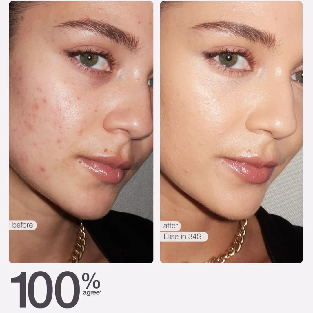 Kosas Revealer Concealer | Medium Coverage | Hydrating Formula | Natural Finish