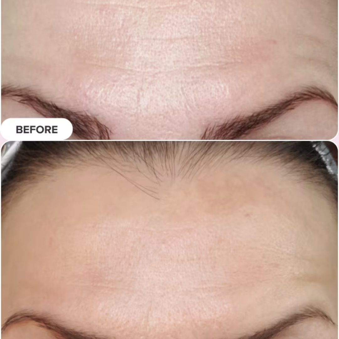 Torriden Cellmazing Pore Perfecting Ampoule | Smooths, Tightens & Hydrates Pores | Improves 8 Pore Concerns