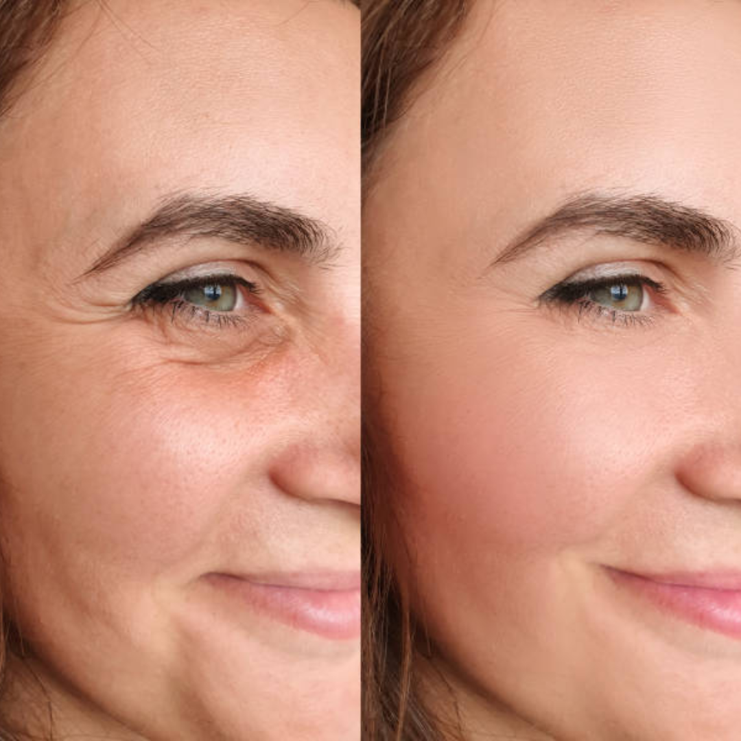 Axis-y Pore Clarifying & Acne treatment Mask | Gently clean pores & remove ance | bright & clean skin