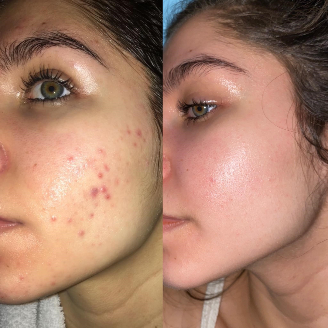 Arencia Vitamin C Cream | Removes Dark Spots & Pigmentation | Reduces Fine Lines & Wrinkles | Anti-Aging & Acne Mark Fading | Deep Hydration & Skin Brightening