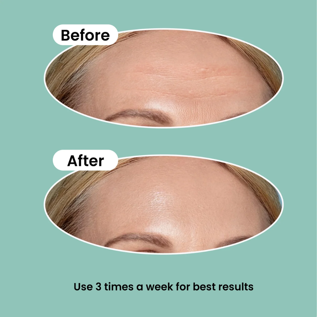 Torriden Cellmazing Pore Perfecting Ampoule | Smooths, Tightens & Hydrates Pores | Improves 8 Pore Concerns