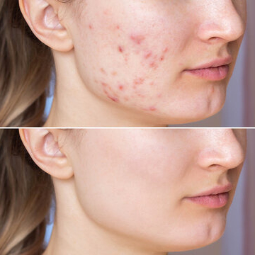 Arencia Vitamin C Cream | Removes Dark Spots & Pigmentation | Reduces Fine Lines & Wrinkles | Anti-Aging & Acne Mark Fading | Deep Hydration & Skin Brightening