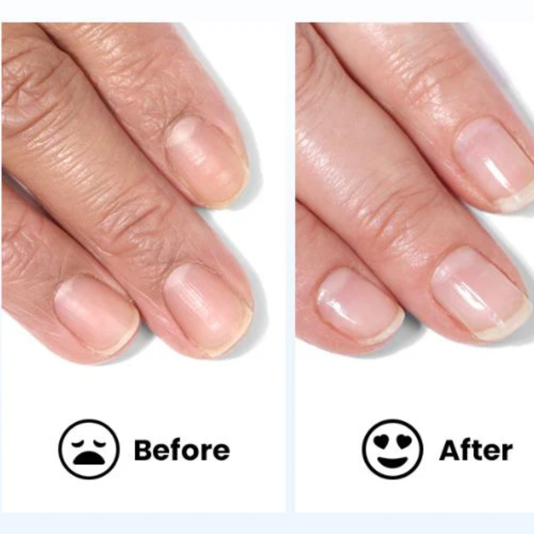 3 Days Nail Repair & Growth Serum – Keratin Amino Acid Formula – 50% OFF – Fast Strengthening & Hydrating – For Dry, Weak & Fragile Nails – Repairs Damage, Promotes Growth
