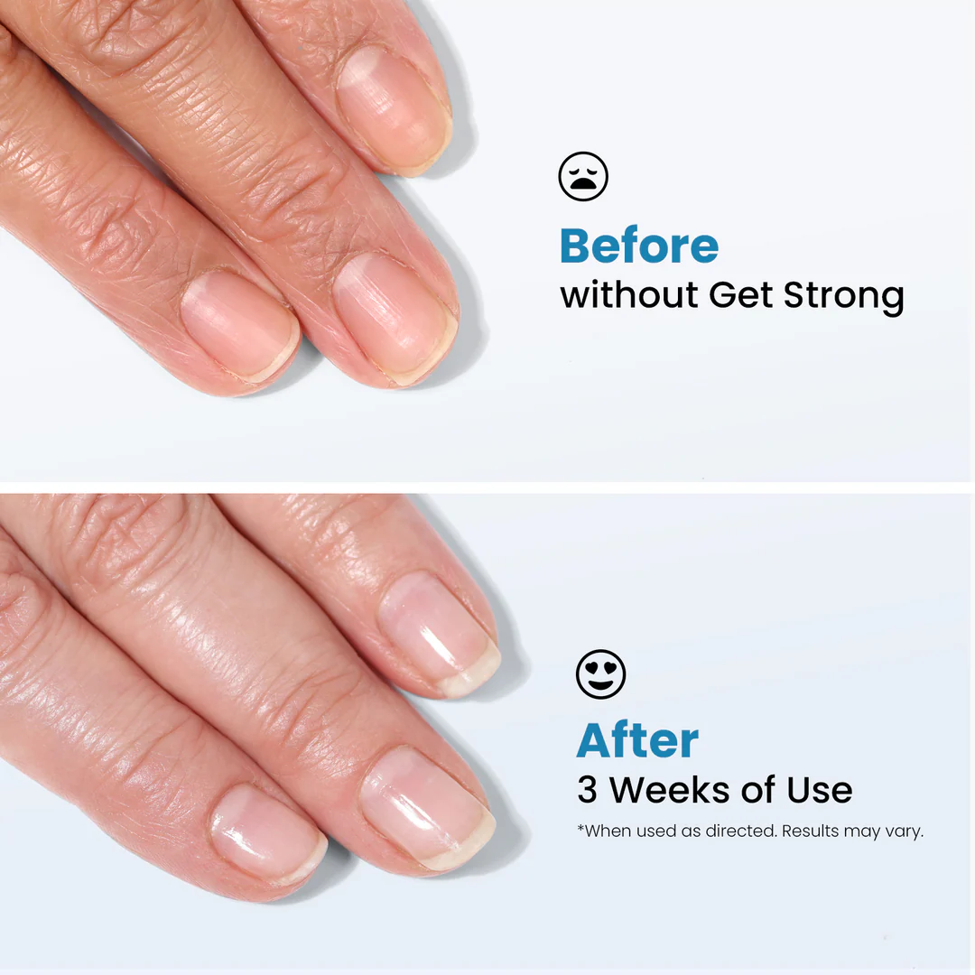 3 Days Nail Repair & Growth Serum – Keratin Amino Acid Formula – 50% OFF – Fast Strengthening & Hydrating – For Dry, Weak & Fragile Nails – Repairs Damage, Promotes Growth