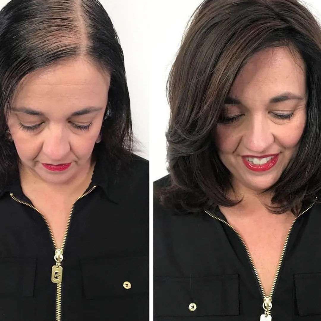Hair Pantry ProGain+ Hair Fall Serum + Frizz Tamer Serum Deal – Stronger Roots, Smoother Hair, Visible Results –  Reduces Hair Fall, Boosts Growth, Tames Frizz