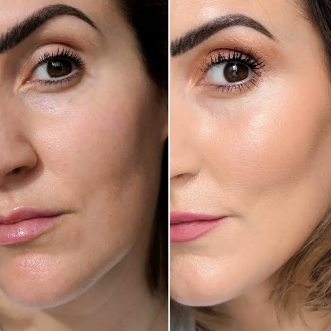 SL Basics BB Block – Flawless Coverage, Everyday Confidence – Broad Spectrum SPF 30+ – Mattifying Finish – Evens Skin Tone, Lightweight, Non-Greasy – All-in-One Protection