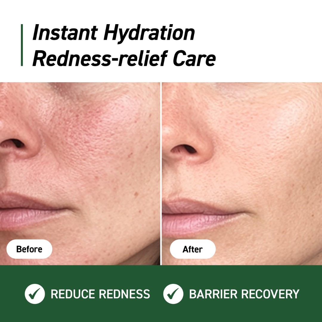 Ivoskin Intensive Cica Repair Cream | 85% Naturally Derived with Madecassoside, Ceramides & Hyaluronic Acid | Calms Redness, Clears Acne & Repairs Skin Barrier