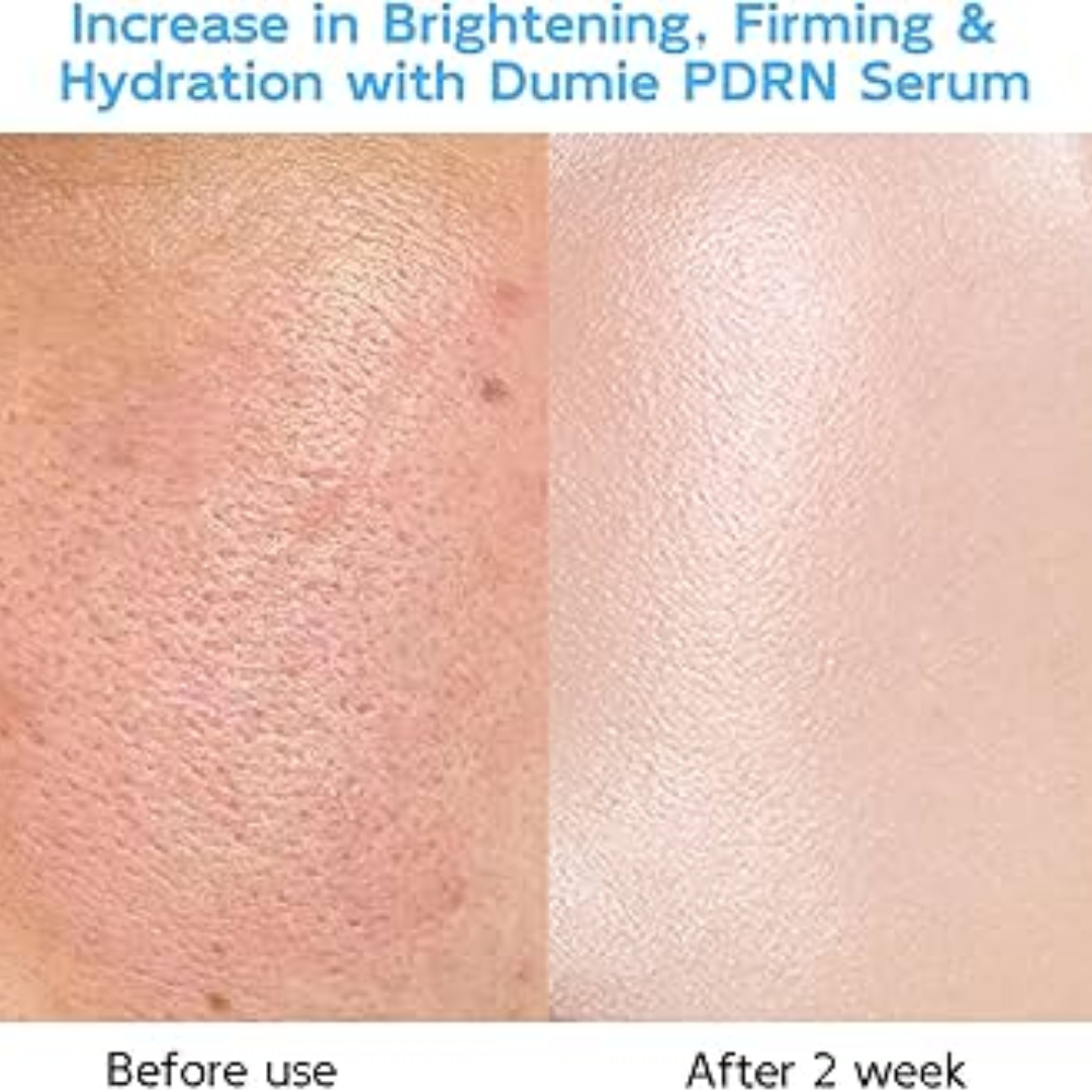 PDRN Volume Booster Cream | 15,000ppm PDRN + Retinal + Peptides | Wrinkle Repair, Skin Firming & Youthful Volume