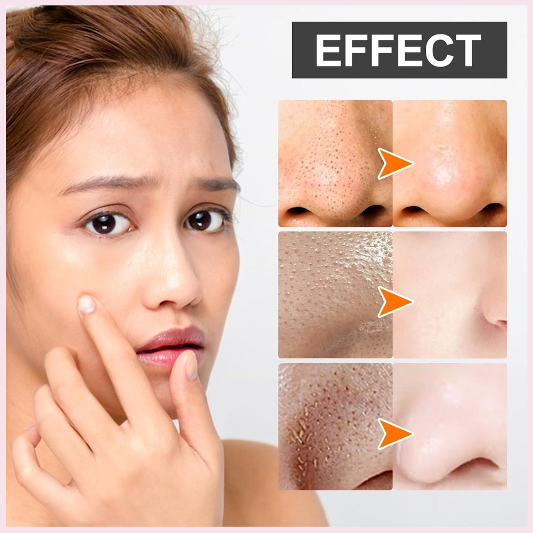 Torriden Cellmazing Pore Perfecting Ampoule | Smooths, Tightens & Hydrates Pores | Improves 8 Pore Concerns