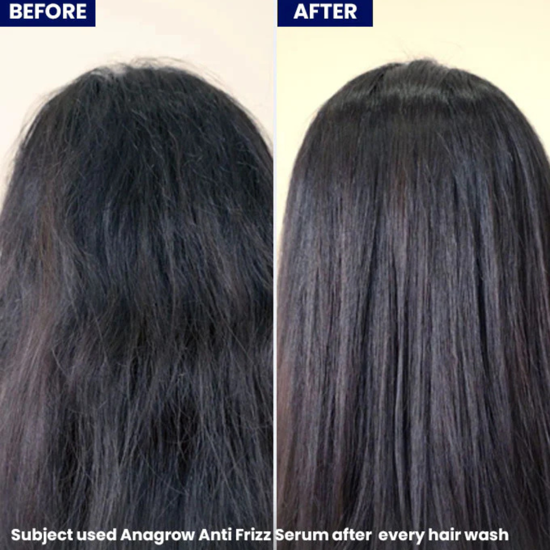 Hair Pantry ProGain+ Hair Fall Serum + Frizz Tamer Serum Deal – Stronger Roots, Smoother Hair, Visible Results –  Reduces Hair Fall, Boosts Growth, Tames Frizz