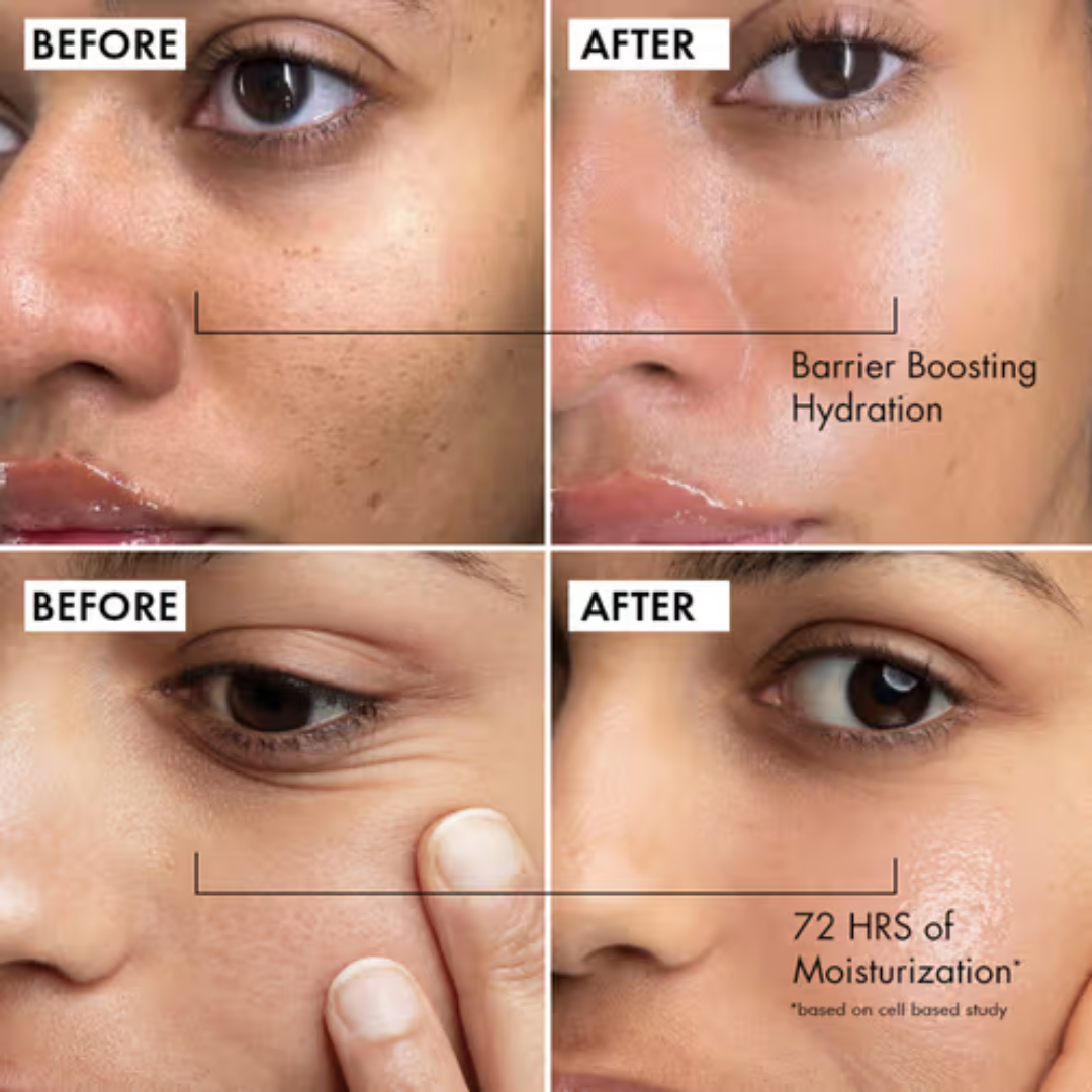 Simple Hydrating Light Moisturiser | 12-Hour Moisture, Vitamin B5+E & Niacinamide, for Sensitive Skin