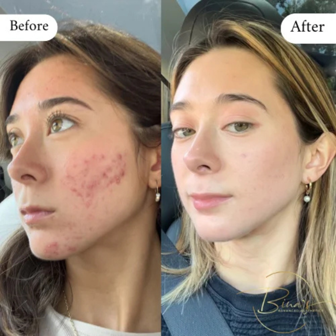 Medicube Collagen Night Wrapping Mask – 50% OFF – Wake Up to Glass Skin – Overnight Care – Boosts Collagen, Deep Hydration & Glass Skin Glow – Strengthens Skin Barrier – For All Skin Types