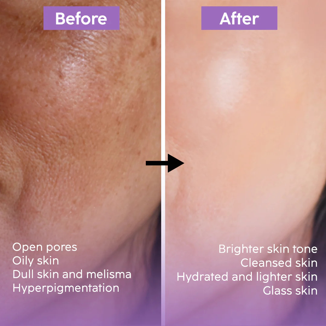 PDRN Volume Booster Cream | 15,000ppm PDRN + Retinal + Peptides | Wrinkle Repair, Skin Firming & Youthful Volume