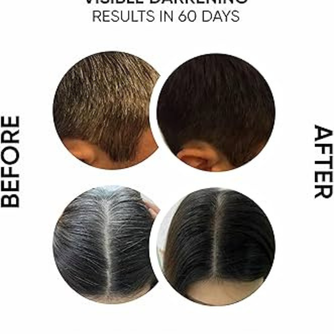 Proskire Anti-Grey Hair Serum – Prevents & Reverses Grey Hair, Reduces White Hair, Darkens & Revitalizes Hair Color – Controls Hair Fall