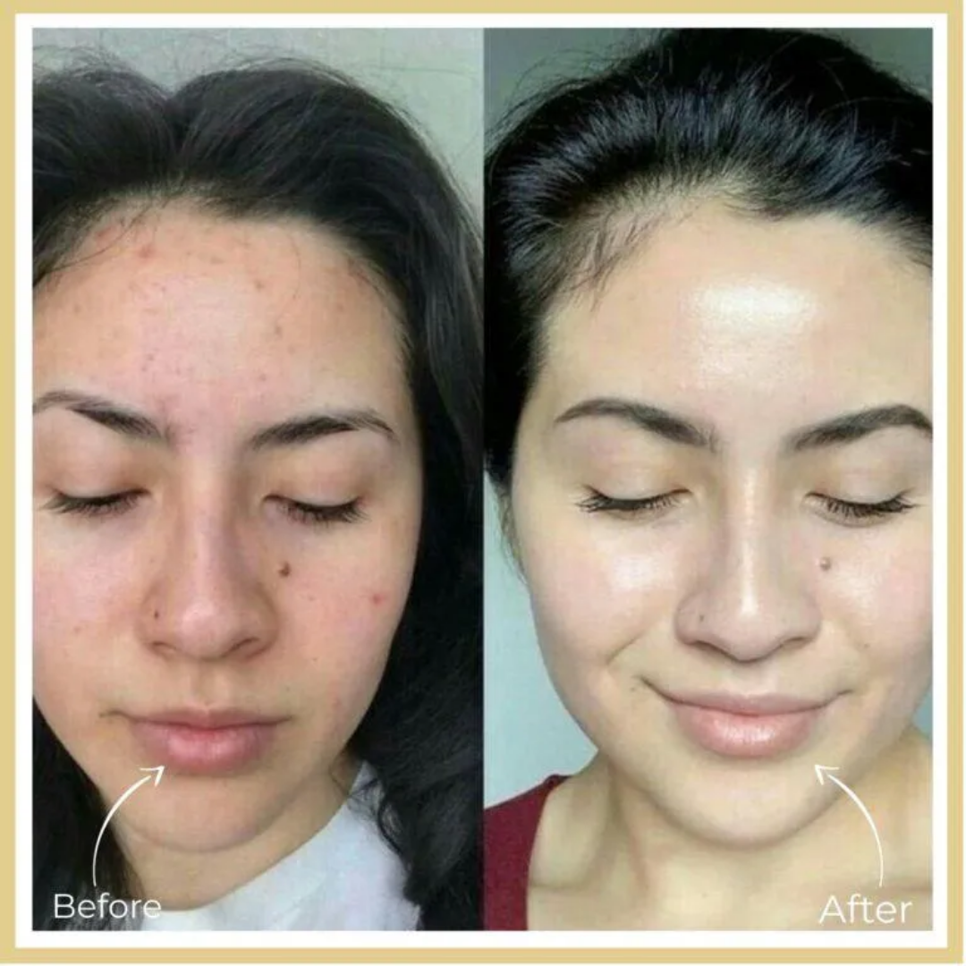 Highfy Beauty Retinol 0.5% Serum | Anti-Aging, Boosts Collagen, Reduces Fine Lines & Wrinkles | Brightens & Smooths Skin