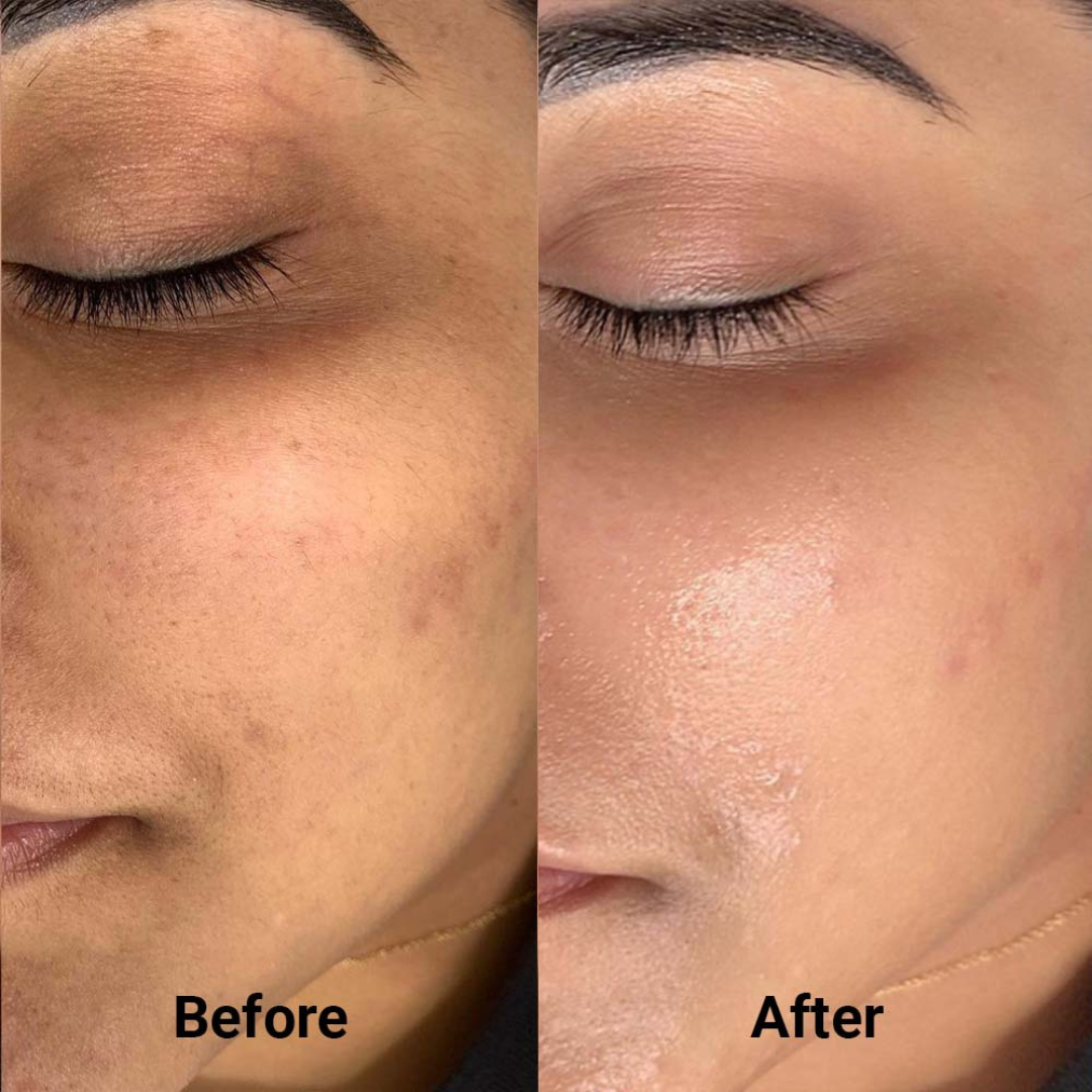 PDRN Volume Booster Cream | 15,000ppm PDRN + Retinal + Peptides | Wrinkle Repair, Skin Firming & Youthful Volume
