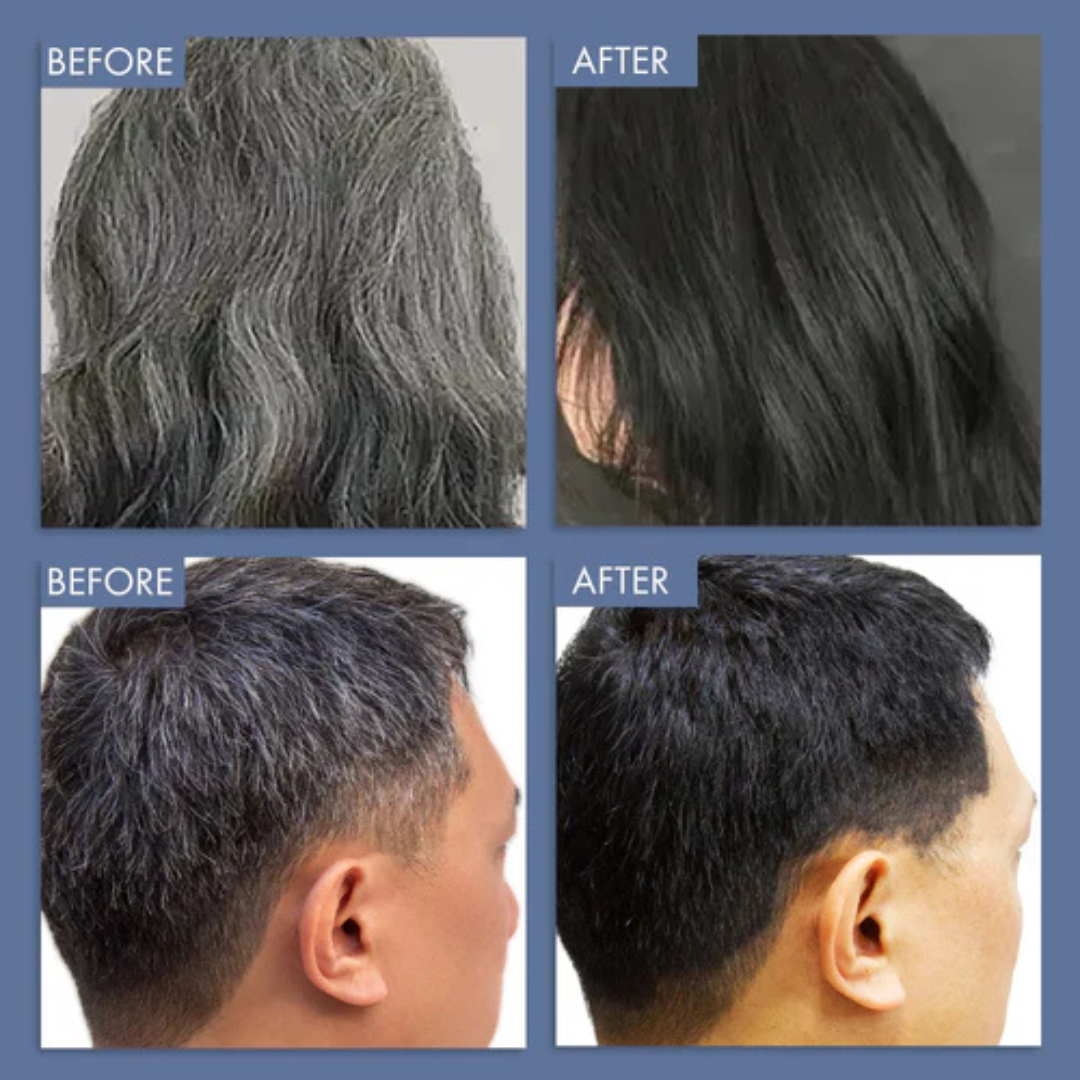 Proskire Anti-Grey Hair Serum – Prevents & Reverses Grey Hair, Reduces White Hair, Darkens & Revitalizes Hair Color – Controls Hair Fall