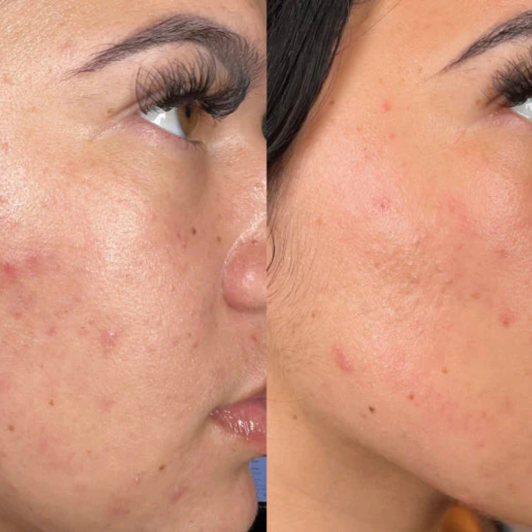 KINUI Calm-7 Soothing Serum | 7 Skin-Perfecting Ingredients with 3 Types of CICA, PDRN, Niacinamide, Panthenol & Tea Tree | Pore Control, Oil Balance & Pigmentation Care