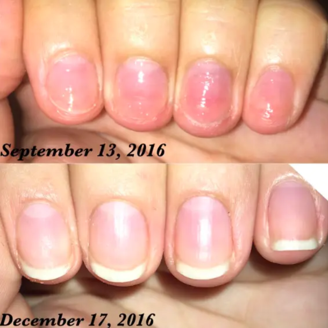 3 Days Nail Repair & Growth Serum – Keratin Amino Acid Formula – 50% OFF – Fast Strengthening & Hydrating – For Dry, Weak & Fragile Nails – Repairs Damage, Promotes Growth