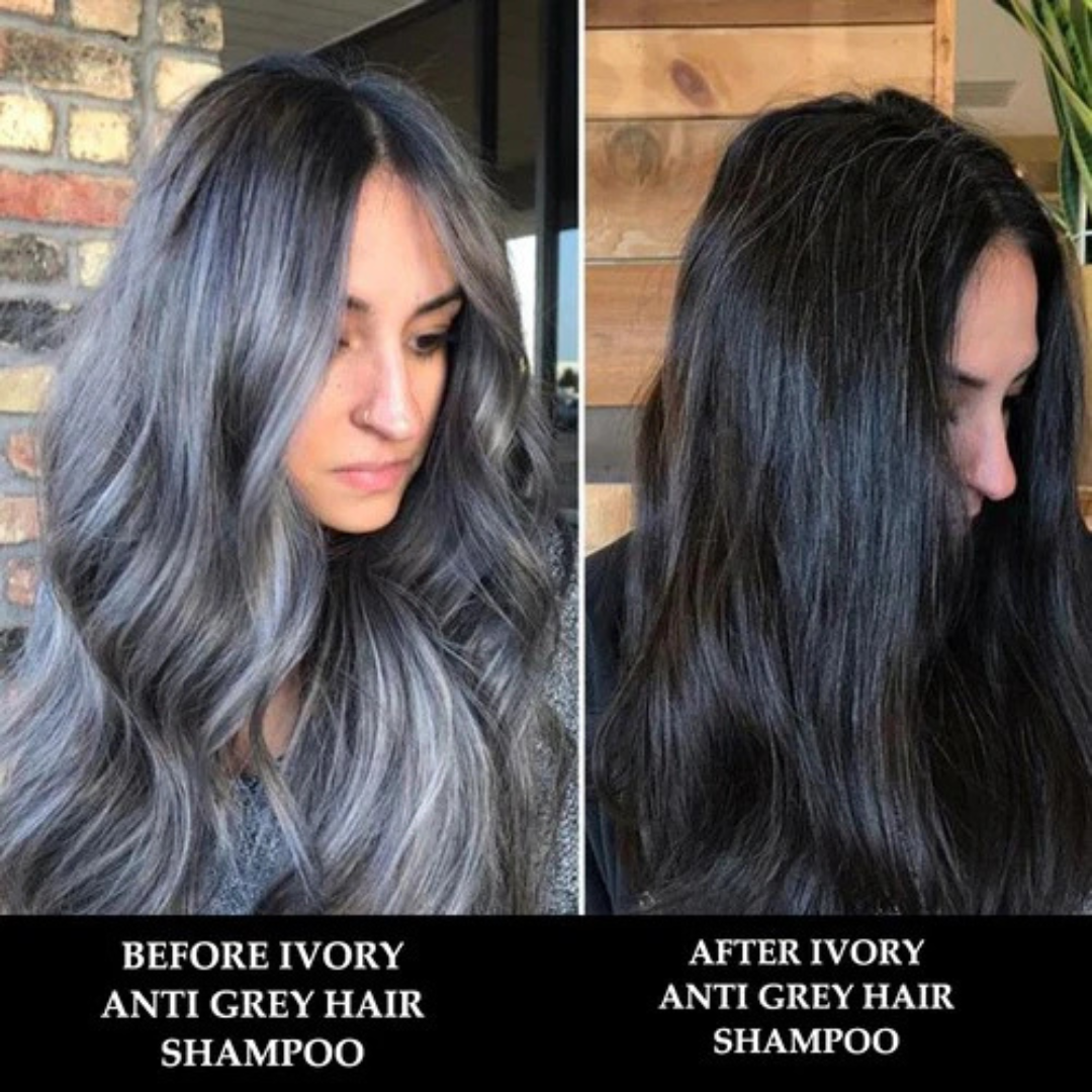Proskire Anti-Grey Hair Serum – Prevents & Reverses Grey Hair, Reduces White Hair, Darkens & Revitalizes Hair Color – Controls Hair Fall