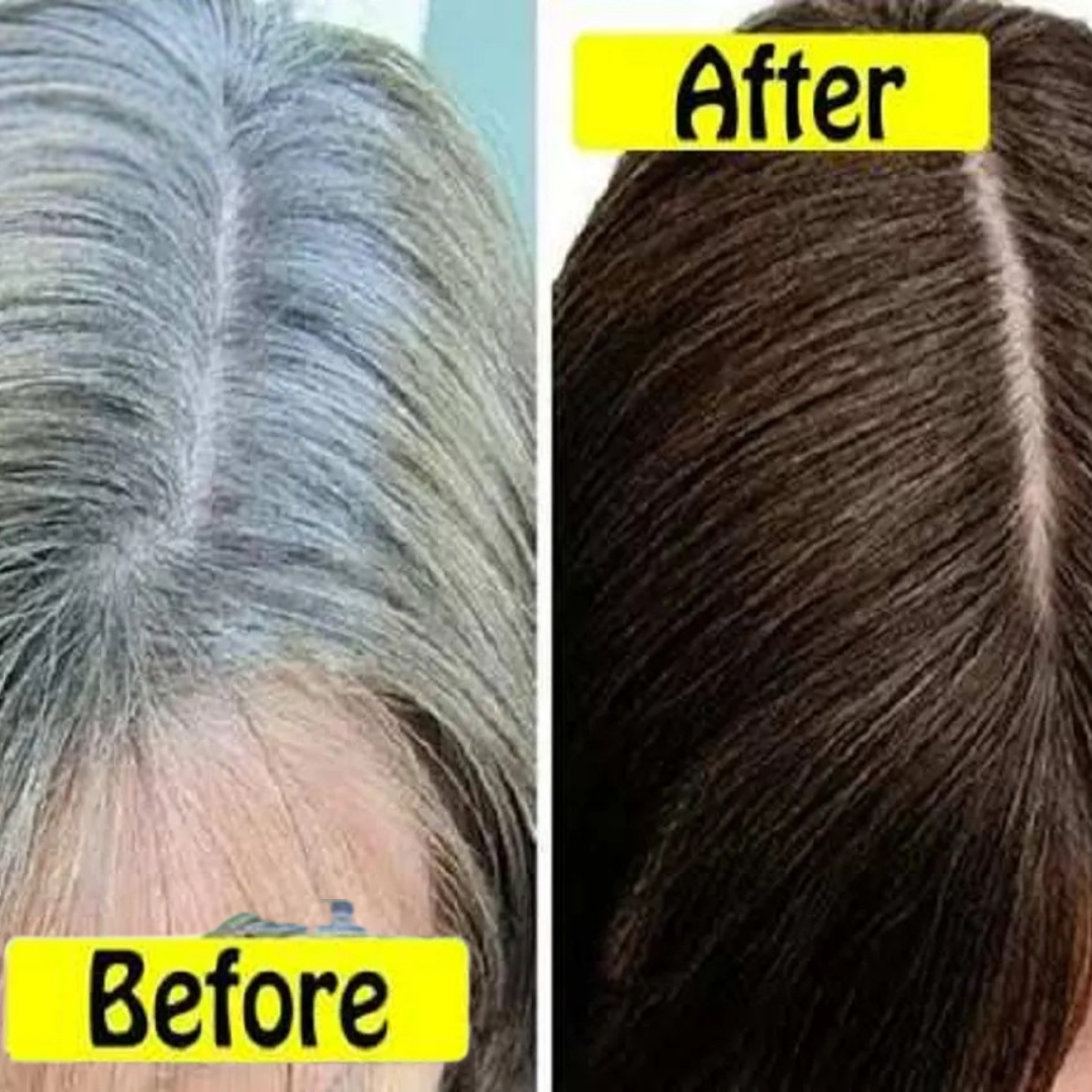 Proskire Anti-Grey Hair Serum – Prevents & Reverses Grey Hair, Reduces White Hair, Darkens & Revitalizes Hair Color – Controls Hair Fall