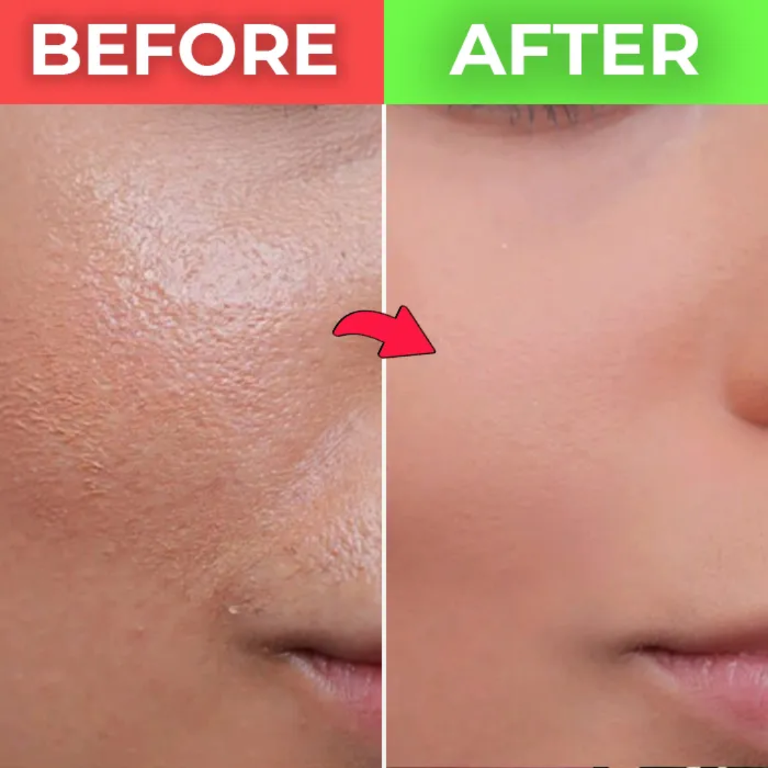 KINUI Calm-7 Soothing Serum | 7 Skin-Perfecting Ingredients with 3 Types of CICA, PDRN, Niacinamide, Panthenol & Tea Tree | Pore Control, Oil Balance & Pigmentation Care