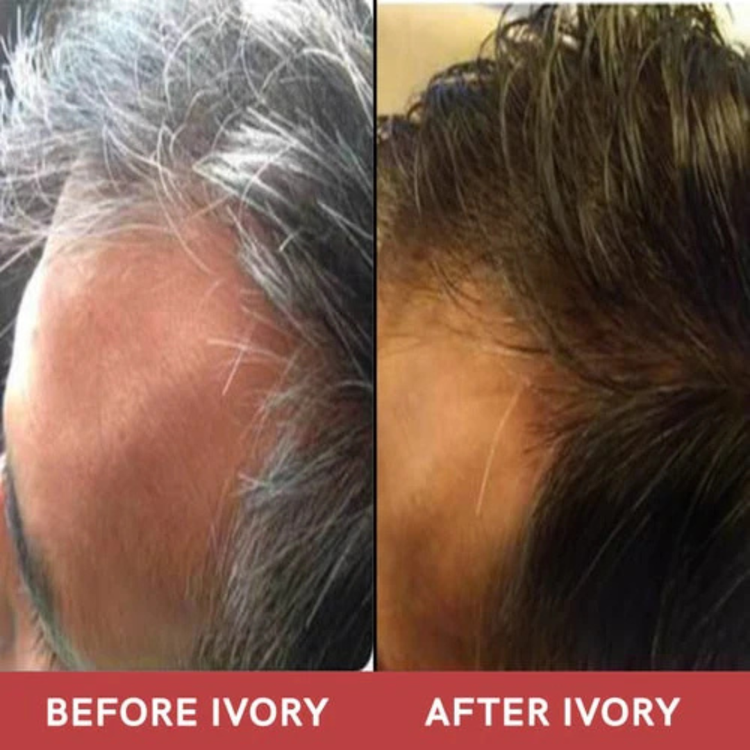 Proskire Anti-Grey Hair Serum – Prevents & Reverses Grey Hair, Reduces White Hair, Darkens & Revitalizes Hair Color – Controls Hair Fall