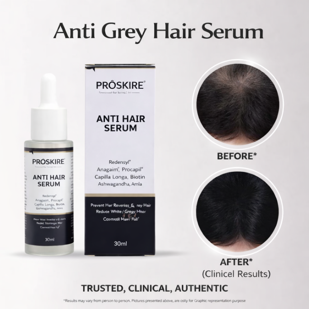 Proskire Anti-Grey Hair Serum – Prevents & Reverses Grey Hair, Reduces White Hair, Darkens & Revitalizes Hair Color – Controls Hair Fall