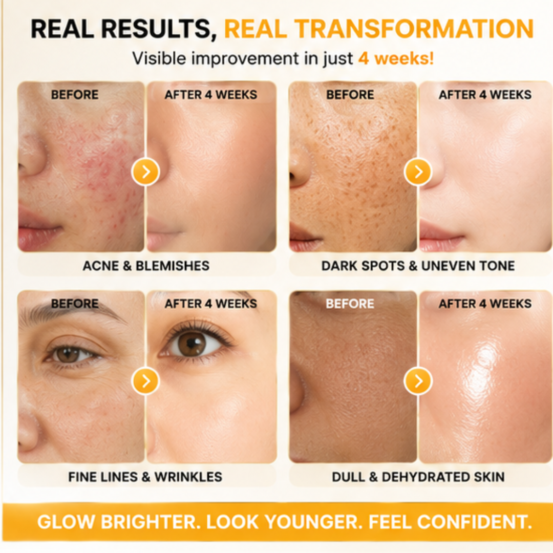 Arencia Vitamin C Cream | Removes Dark Spots & Pigmentation | Reduces Fine Lines & Wrinkles | Anti-Aging & Acne Mark Fading | Deep Hydration & Skin Brightening