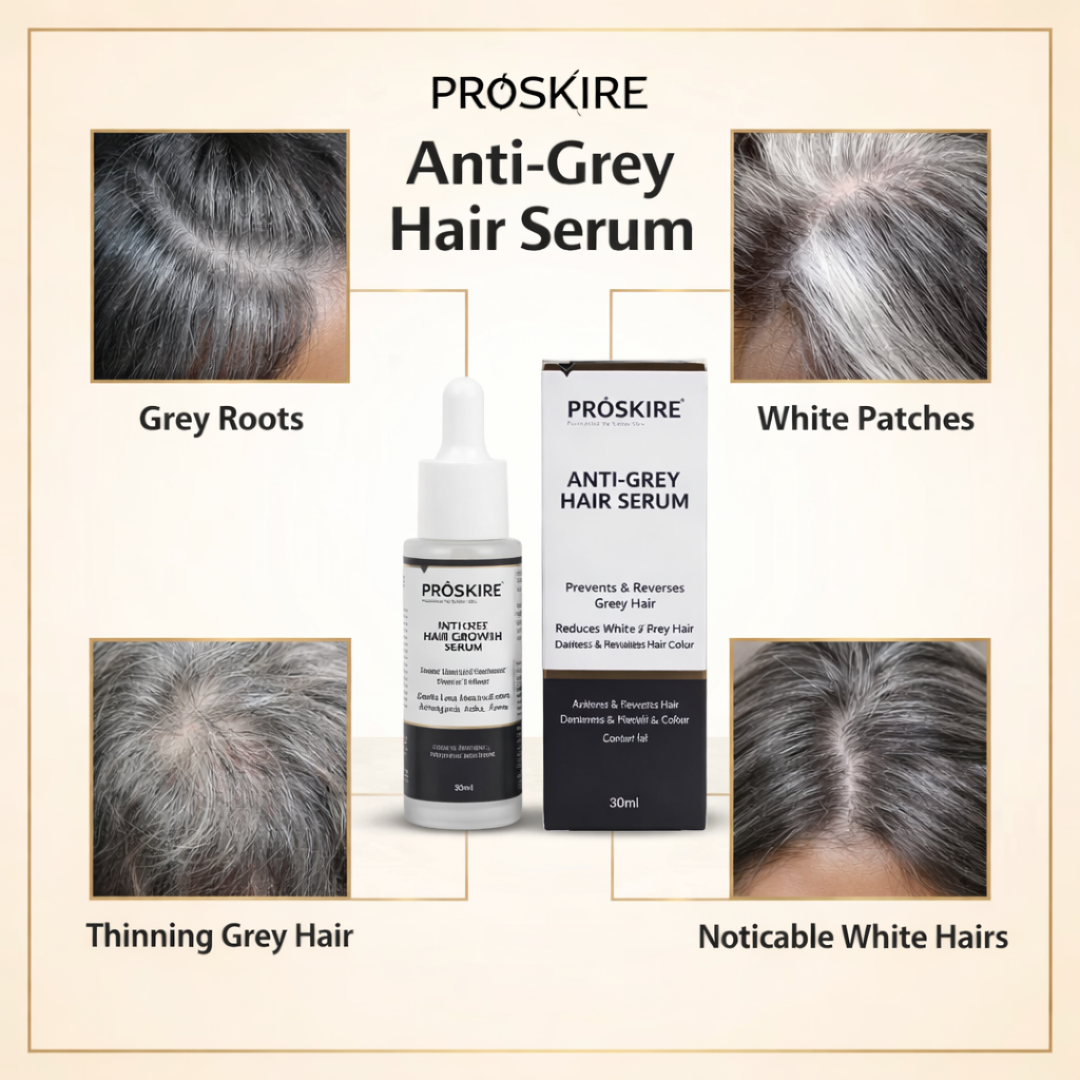 Proskire Anti-Grey Hair Serum – Prevents & Reverses Grey Hair, Reduces White Hair, Darkens & Revitalizes Hair Color – Controls Hair Fall