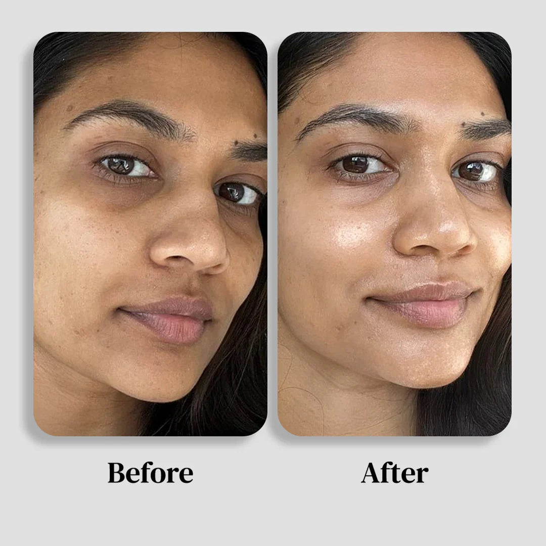 Arencia Vitamin C Cream | Removes Dark Spots & Pigmentation | Reduces Fine Lines & Wrinkles | Anti-Aging & Acne Mark Fading | Deep Hydration & Skin Brightening