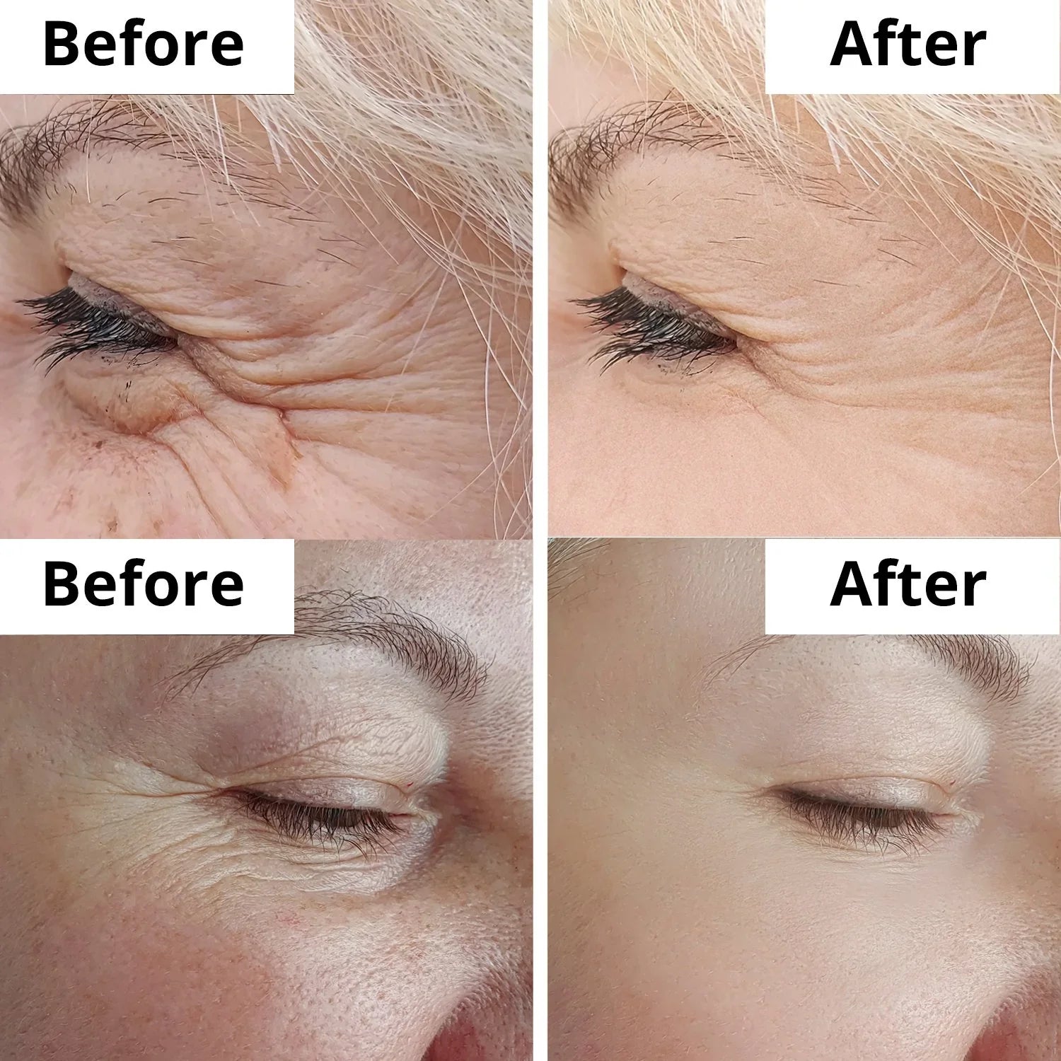 K-SECRET Seoul 1988 Retinal Cream – For Dark Circles, Fine Lines & Brightening – Smooths Texture, Firms Skin, Hydrates & Balances Tone – Anti-Aging Intensive Eye Zone Care